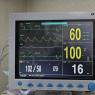 Monitor Multiparametrico