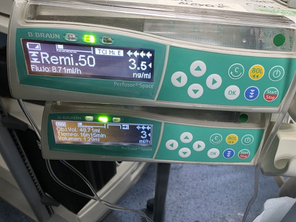 Bomba de infusion TCI