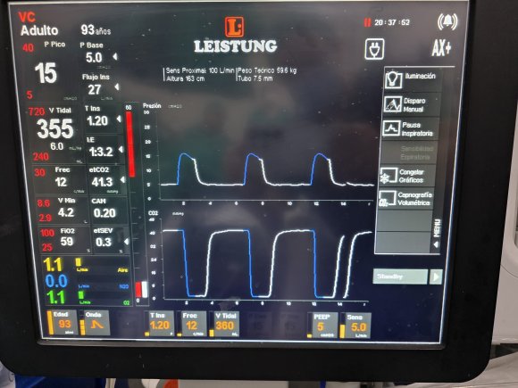 Ventilador mecánico marca Leistung