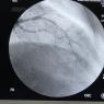 Cateterismo Cardiaco Lesiones DA
